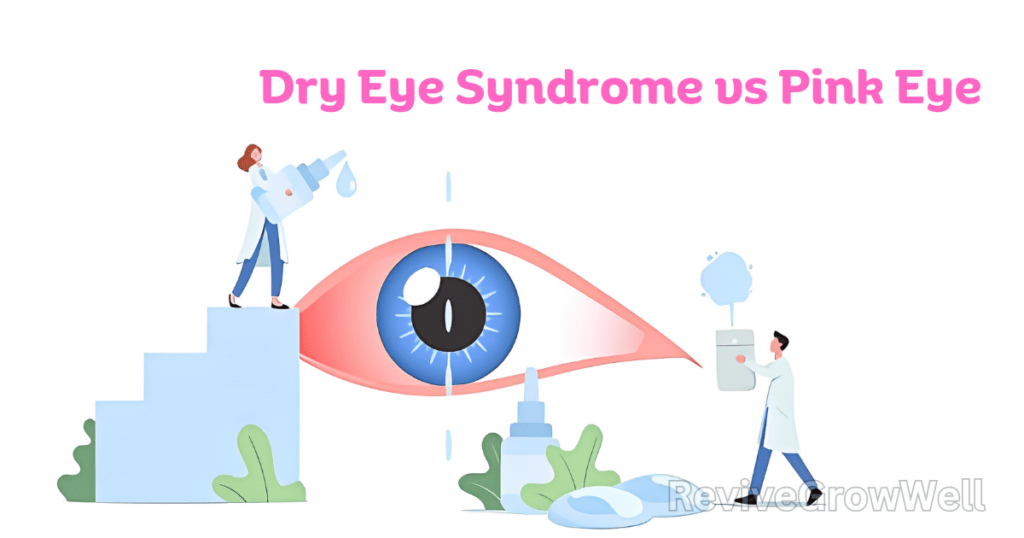 Dry-Eye-Syndrome