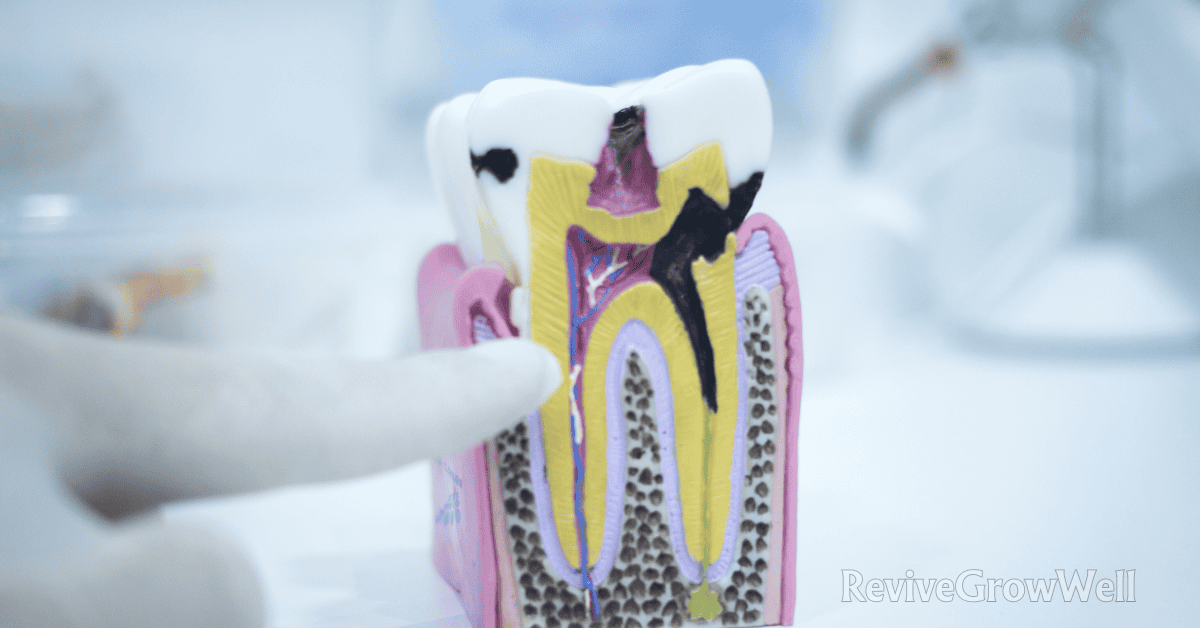 Can You Kill Tooth Pain Nerve In 3 Seconds Permanently? Myths And Real ...