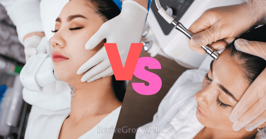 IPL-vs-microdermabrasion